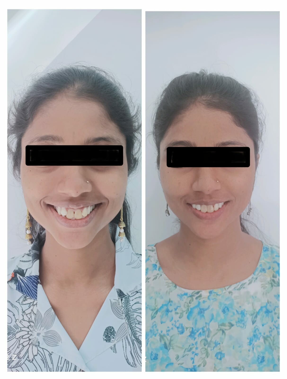 Dr. Gulhane's Urology & Dental Clinic|Hadapsar,Pune